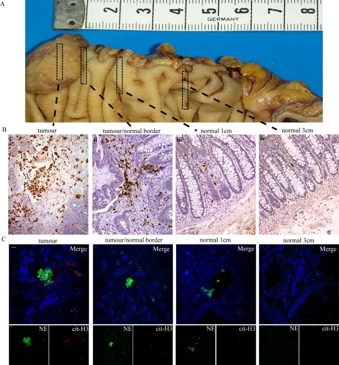 https://cdn.ncbi.nlm.nih.gov/pmc/blobs/a381/4852909/910f03822a1c/pone.0154484.g002.jpg