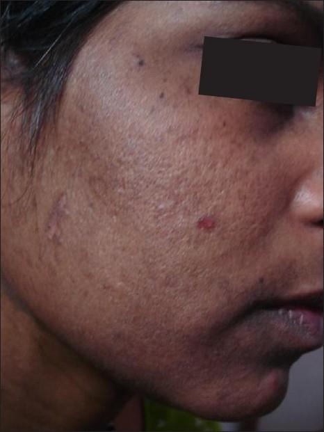 https://cdn.ncbi.nlm.nih.gov/pmc/blobs/a383/3051299/8846f69edcd1/IJD-55-367-g002.jpg