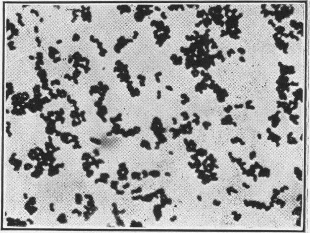 https://cdn.ncbi.nlm.nih.gov/pmc/blobs/a38b/1996356/141e912d28ed/pubhealthreporig01965-0015-d.jpg