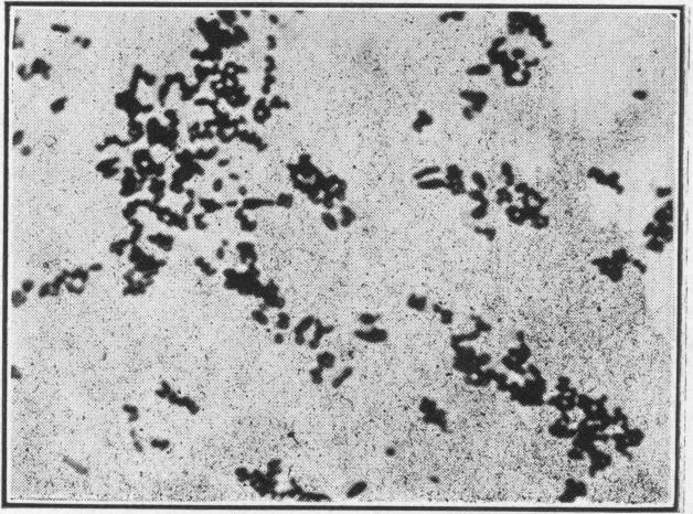 https://cdn.ncbi.nlm.nih.gov/pmc/blobs/a38b/1996356/490f7e530625/pubhealthreporig01965-0015-f.jpg