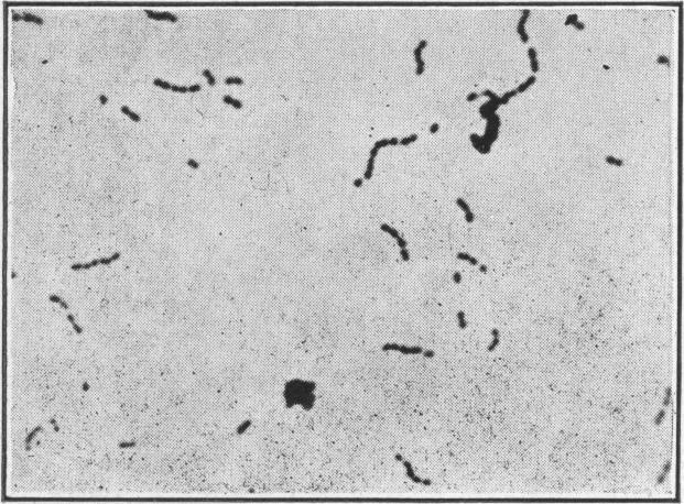 https://cdn.ncbi.nlm.nih.gov/pmc/blobs/a38b/1996356/9c5b4b2e90cb/pubhealthreporig01965-0015-e.jpg