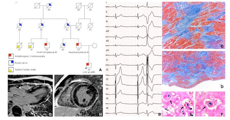 https://cdn.ncbi.nlm.nih.gov/pmc/blobs/a38e/6367696/3da704164430/CCR-15-12_F5.jpg