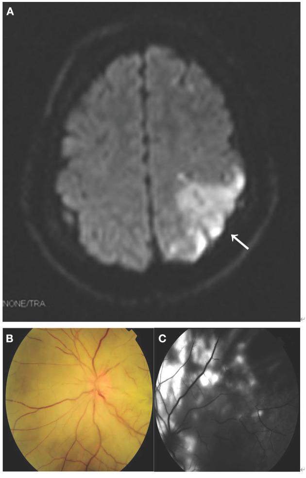 https://cdn.ncbi.nlm.nih.gov/pmc/blobs/a394/8688397/81c9ac443339/fmed-08-646657-g0002.jpg