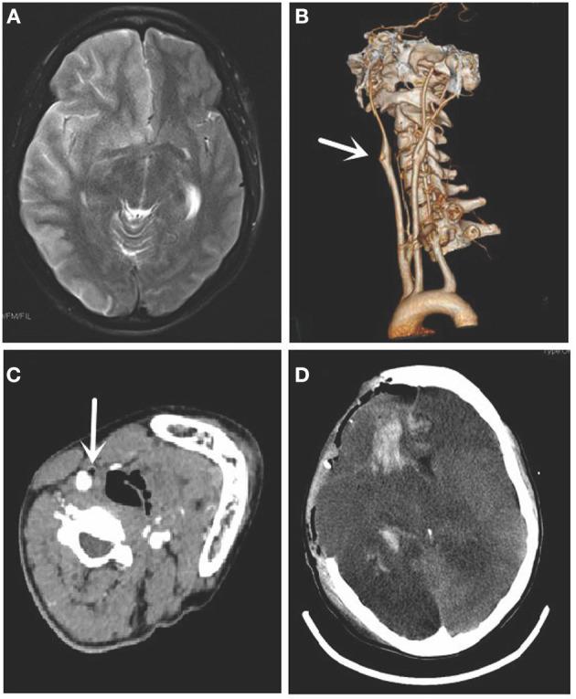 https://cdn.ncbi.nlm.nih.gov/pmc/blobs/a394/8688397/e57c29f95421/fmed-08-646657-g0001.jpg