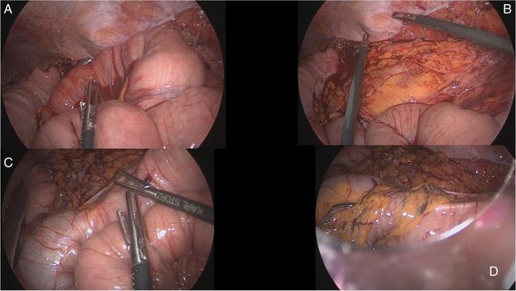 https://cdn.ncbi.nlm.nih.gov/pmc/blobs/a396/8847254/a99f1ef8799c/423_2021_2240_Fig5_HTML.jpg