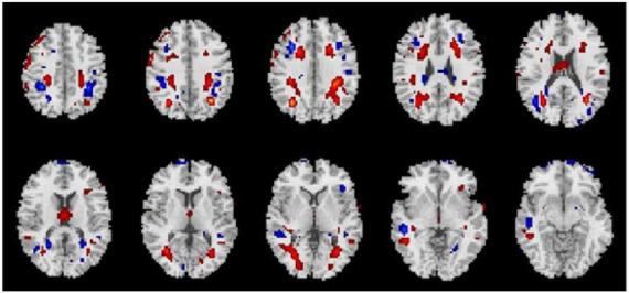 https://cdn.ncbi.nlm.nih.gov/pmc/blobs/a396/9513041/41e32b65e8e7/fpsyt-13-962918-g003.jpg
