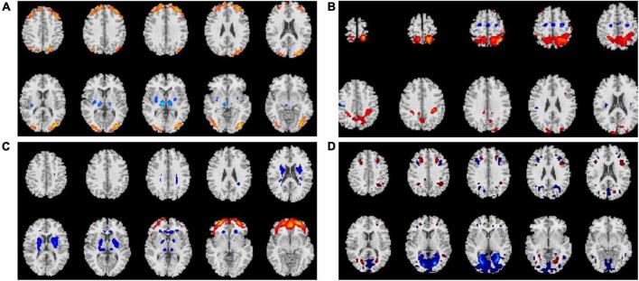 https://cdn.ncbi.nlm.nih.gov/pmc/blobs/a396/9513041/b24a68b98516/fpsyt-13-962918-g002.jpg