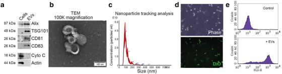 https://cdn.ncbi.nlm.nih.gov/pmc/blobs/a39f/9122835/2f9fecd60ce3/JEV2-11-e12226-g008.jpg