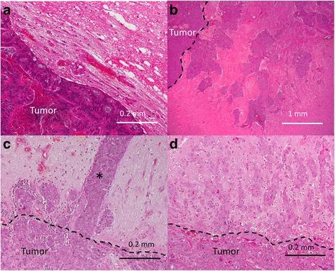 https://cdn.ncbi.nlm.nih.gov/pmc/blobs/a3a2/5622438/6d728780f37d/12957_2017_1239_Fig3_HTML.jpg