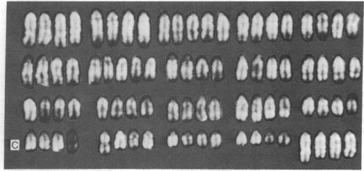 https://cdn.ncbi.nlm.nih.gov/pmc/blobs/a3a3/434331/5200a2382bd4/pnas00073-0289-c.jpg