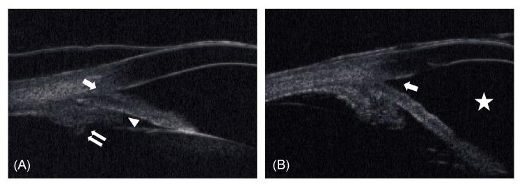 https://cdn.ncbi.nlm.nih.gov/pmc/blobs/a3a4/8912943/291229903b16/cureus-0014-00000022036-i02.jpg