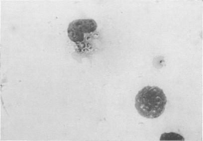 https://cdn.ncbi.nlm.nih.gov/pmc/blobs/a3aa/1997001/e0d38758842f/pubhealthreporig01233-0027-b.jpg