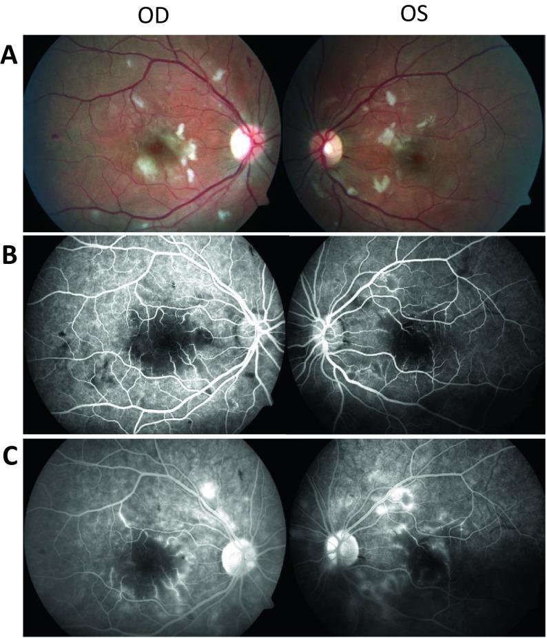 https://cdn.ncbi.nlm.nih.gov/pmc/blobs/a3b5/5876418/43898f635abe/10792_2017_470_Fig1_HTML.jpg