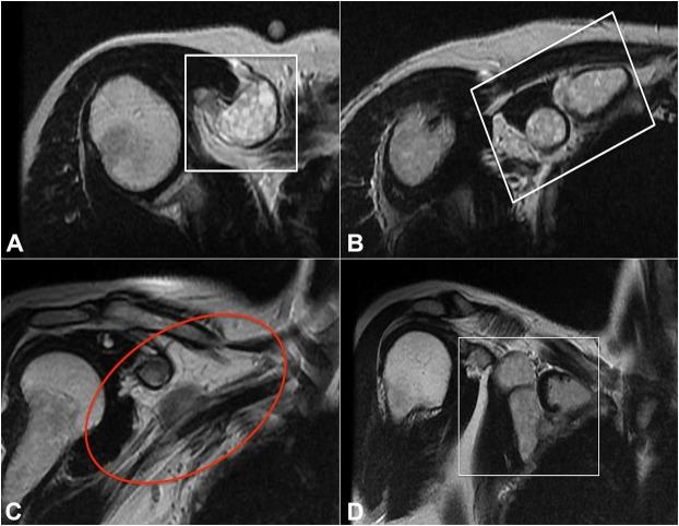 https://cdn.ncbi.nlm.nih.gov/pmc/blobs/a3bc/6433142/5f6d88f0817d/autopsy-09-02e20180780-g02.jpg