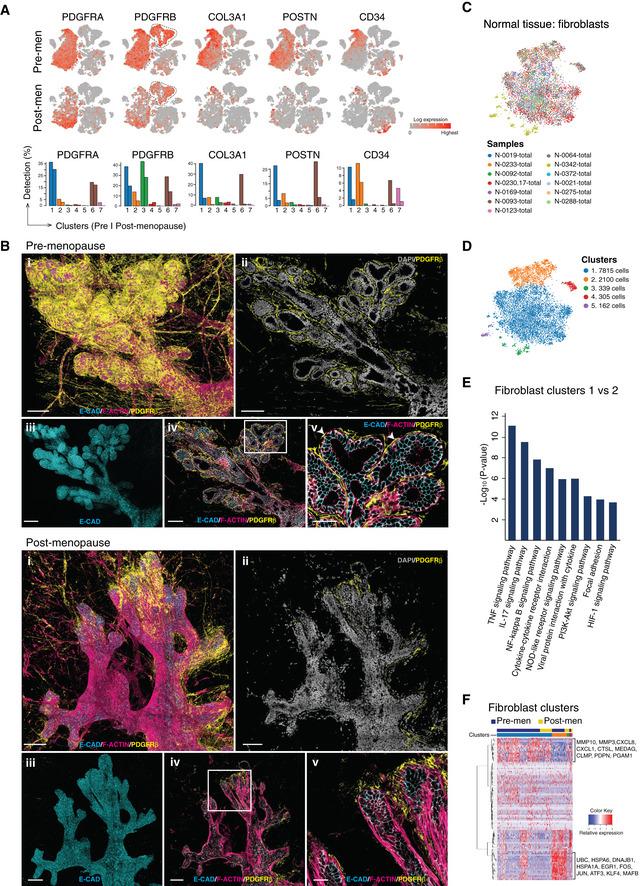 https://cdn.ncbi.nlm.nih.gov/pmc/blobs/a3bd/8167363/becdb668d629/EMBJ-40-e107333-g010.jpg