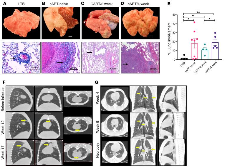 https://cdn.ncbi.nlm.nih.gov/pmc/blobs/a3c2/8803324/56ee74094986/jci-132-153090-g073.jpg