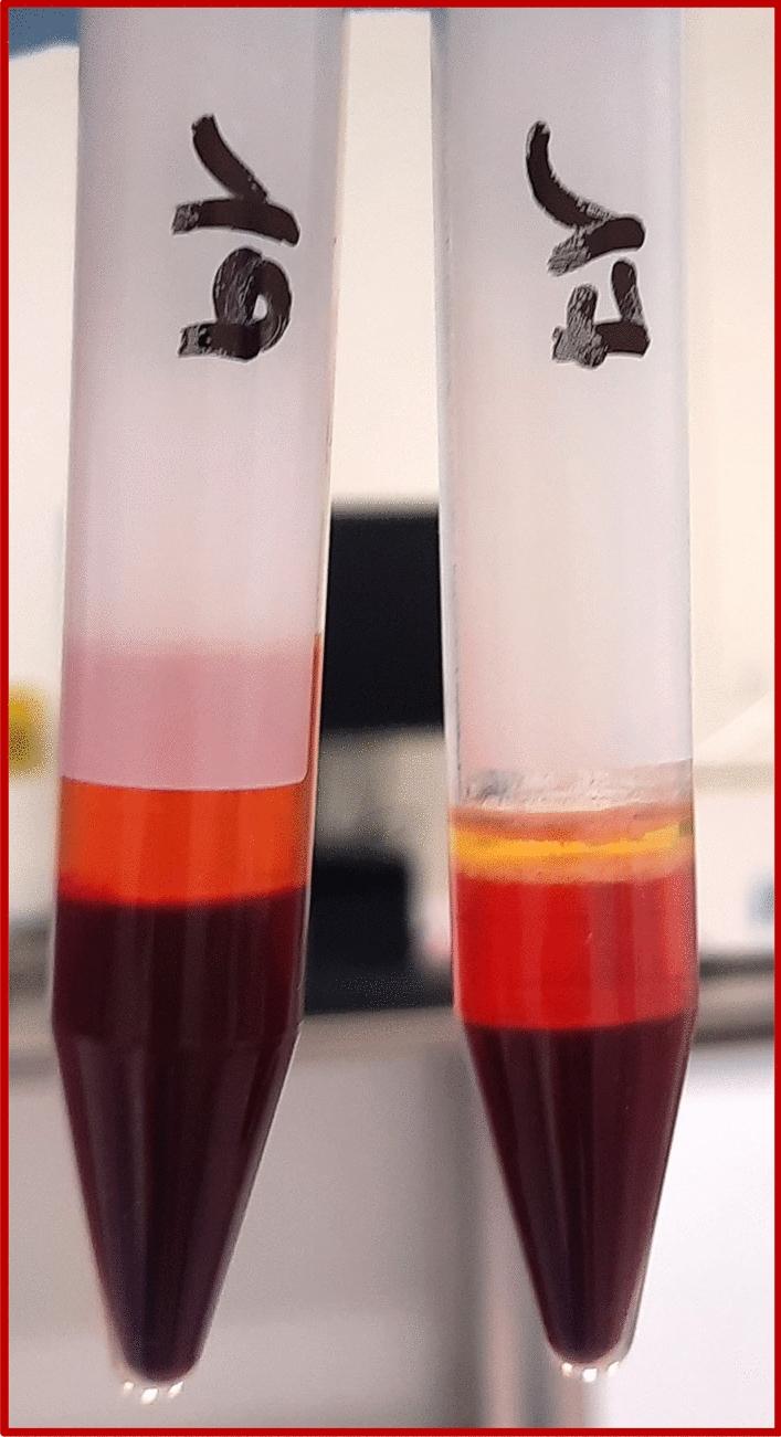 https://cdn.ncbi.nlm.nih.gov/pmc/blobs/a3c5/11616267/7464d4cb5397/12967_2024_5924_Fig4_HTML.jpg