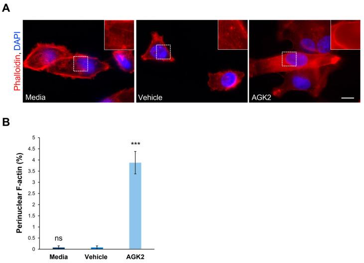 https://cdn.ncbi.nlm.nih.gov/pmc/blobs/a3cd/11639776/8919cbfb35bf/cells-13-02023-g002.jpg