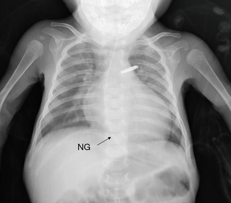 https://cdn.ncbi.nlm.nih.gov/pmc/blobs/a3cf/8649599/953ee83f462d/tp-10-11-3082-f2.jpg