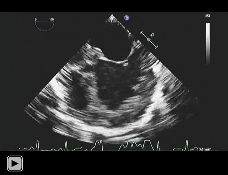 https://cdn.ncbi.nlm.nih.gov/pmc/blobs/a3cf/8649599/cd3e6a24efc2/tp-10-11-3082-vid1.jpg