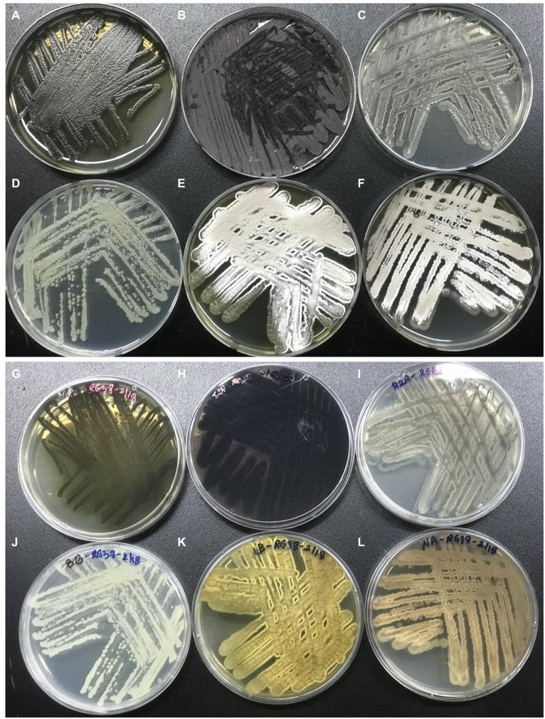 https://cdn.ncbi.nlm.nih.gov/pmc/blobs/a3d3/10940327/196d2c2c5699/fmicb-15-1361583-g005.jpg