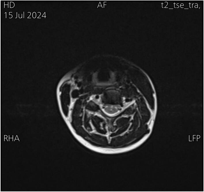 https://cdn.ncbi.nlm.nih.gov/pmc/blobs/a3da/12269853/888213a8bdaa/gr4.jpg