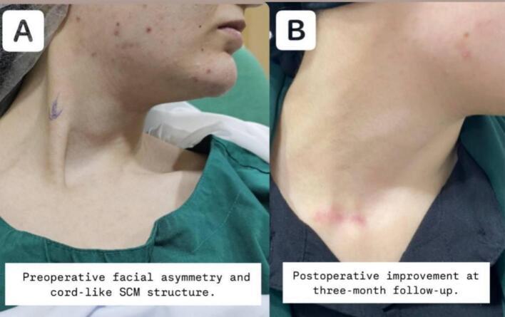 https://cdn.ncbi.nlm.nih.gov/pmc/blobs/a3da/12269853/bff29faa41d0/gr2.jpg
