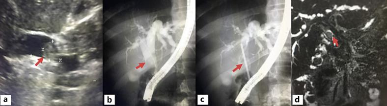 https://cdn.ncbi.nlm.nih.gov/pmc/blobs/a3dc/8787518/2713fc05c001/cro-0014-1785-g01.jpg