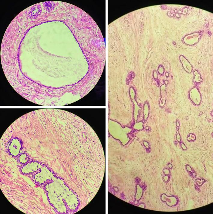 https://cdn.ncbi.nlm.nih.gov/pmc/blobs/a3de/7752576/e164c8ec2a03/CCR3-8-3489-g004.jpg