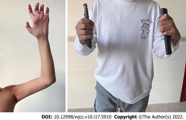 https://cdn.ncbi.nlm.nih.gov/pmc/blobs/a3e2/9258380/24c5e62b1afe/WJCC-10-5910-g004.jpg