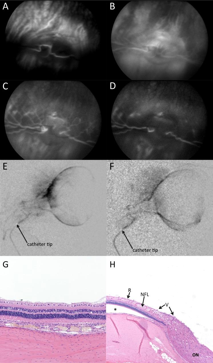 https://cdn.ncbi.nlm.nih.gov/pmc/blobs/a3ea/5783625/118bcdae61ab/i1552-5783-59-1-446-f02.jpg