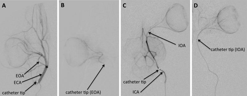 https://cdn.ncbi.nlm.nih.gov/pmc/blobs/a3ea/5783625/3dbfba7e206b/i1552-5783-59-1-446-f01.jpg
