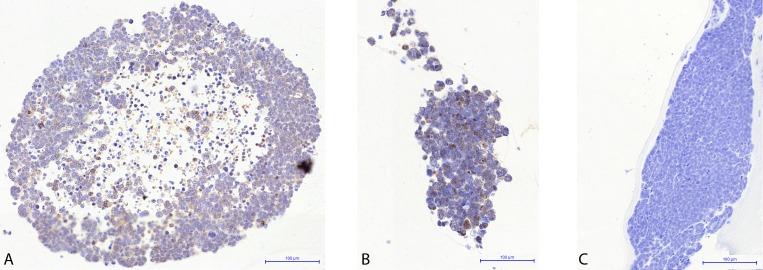https://cdn.ncbi.nlm.nih.gov/pmc/blobs/a3ea/5783625/6c9ccd8c372a/i1552-5783-59-1-446-f06.jpg