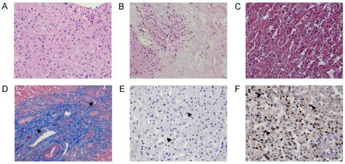https://cdn.ncbi.nlm.nih.gov/pmc/blobs/a3ed/6966196/b718a470299b/etm-19-02-1275-g01.jpg