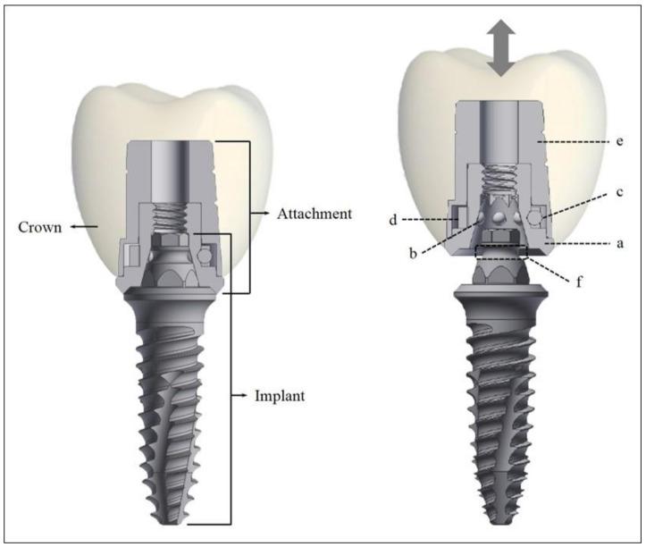 https://cdn.ncbi.nlm.nih.gov/pmc/blobs/a3f3/5951448/8eec2908c471/materials-11-00564-g001.jpg