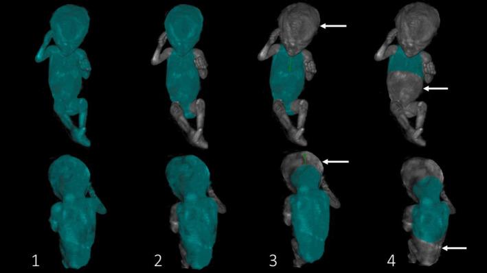 https://cdn.ncbi.nlm.nih.gov/pmc/blobs/a3f7/8251560/b6463b63b2b8/PD-41-868-g002.jpg