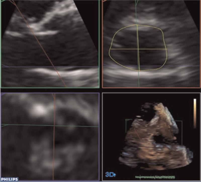 https://cdn.ncbi.nlm.nih.gov/pmc/blobs/a403/7939191/6daf4d06d5a5/medi-100-e24682-g001.jpg
