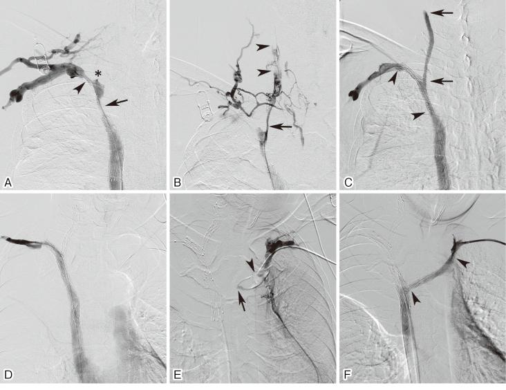https://cdn.ncbi.nlm.nih.gov/pmc/blobs/a404/12078050/25c60634b152/2432-0935-10-e2023-0043-g006.jpg
