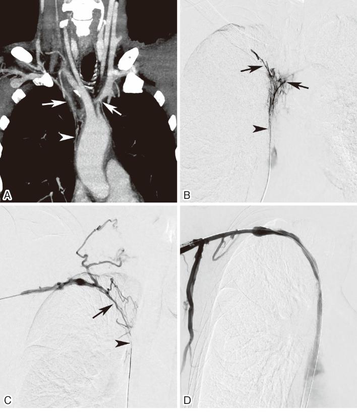 https://cdn.ncbi.nlm.nih.gov/pmc/blobs/a404/12078050/4b5c4dce3023/2432-0935-10-e2023-0043-g003.jpg