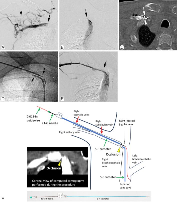 https://cdn.ncbi.nlm.nih.gov/pmc/blobs/a404/12078050/7fa41c794742/2432-0935-10-e2023-0043-g008.jpg