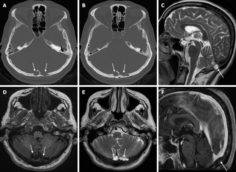 https://cdn.ncbi.nlm.nih.gov/pmc/blobs/a405/12210201/0cbb44eb247a/wjr-17-6-107776-g001.jpg