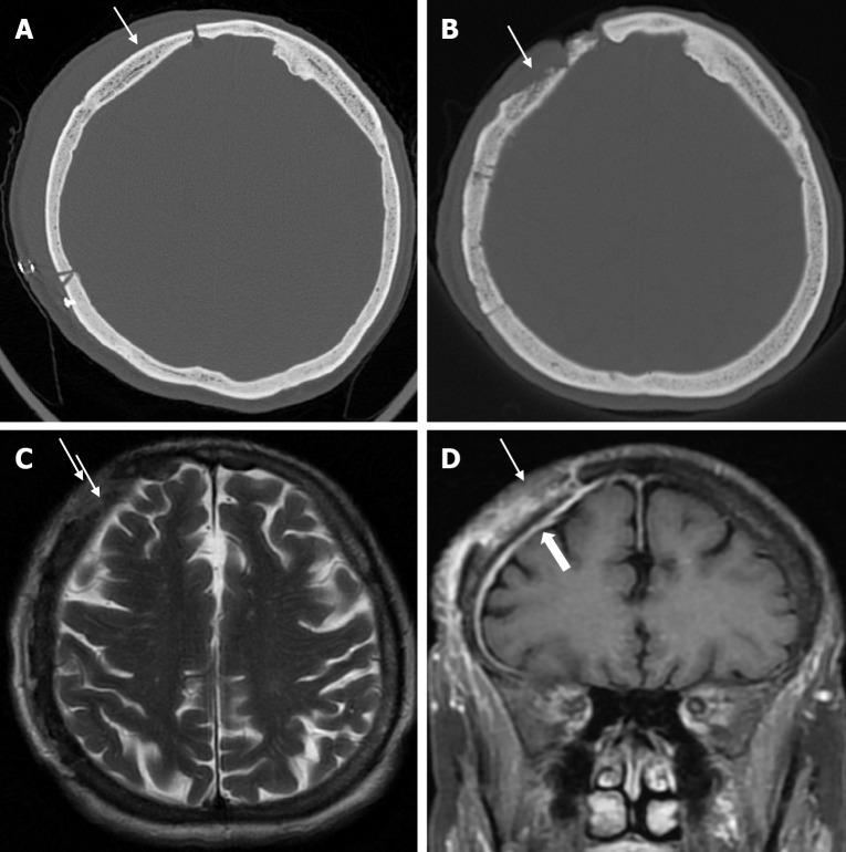 https://cdn.ncbi.nlm.nih.gov/pmc/blobs/a405/12210201/503679bc22a1/wjr-17-6-107776-g012.jpg