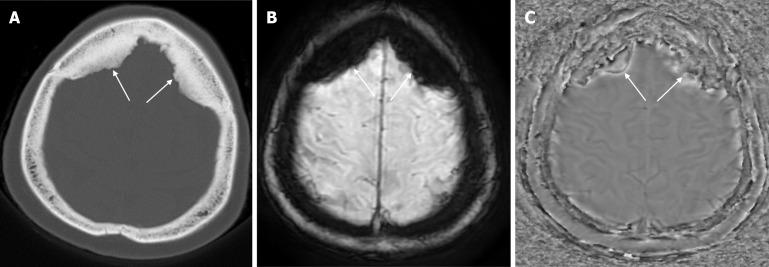 https://cdn.ncbi.nlm.nih.gov/pmc/blobs/a405/12210201/8c2c81f2d6a7/wjr-17-6-107776-g011.jpg