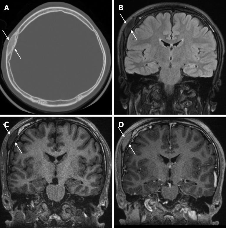 https://cdn.ncbi.nlm.nih.gov/pmc/blobs/a405/12210201/956e94827a6c/wjr-17-6-107776-g019.jpg