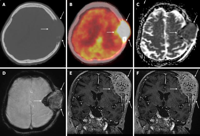 https://cdn.ncbi.nlm.nih.gov/pmc/blobs/a405/12210201/b3501dd0839a/wjr-17-6-107776-g024.jpg