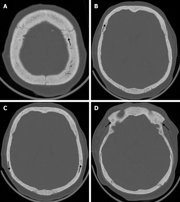 https://cdn.ncbi.nlm.nih.gov/pmc/blobs/a405/12210201/c8bd9a88f191/wjr-17-6-107776-g015.jpg