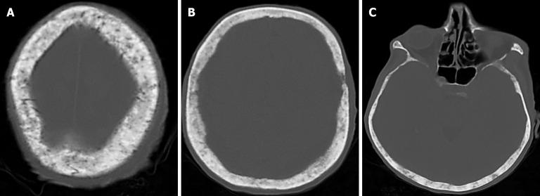 https://cdn.ncbi.nlm.nih.gov/pmc/blobs/a405/12210201/cac253e649dd/wjr-17-6-107776-g025.jpg