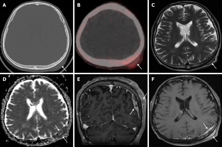 https://cdn.ncbi.nlm.nih.gov/pmc/blobs/a405/12210201/e4c528fd3f36/wjr-17-6-107776-g026.jpg