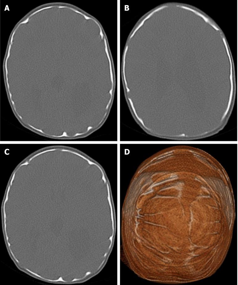 https://cdn.ncbi.nlm.nih.gov/pmc/blobs/a405/12210201/f35274d46ebd/wjr-17-6-107776-g005.jpg