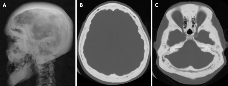 https://cdn.ncbi.nlm.nih.gov/pmc/blobs/a405/12210201/f378d7af8706/wjr-17-6-107776-g013.jpg